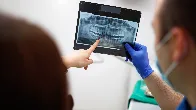 Routine dental X-rays are not backed by evidence–experts want it to stop