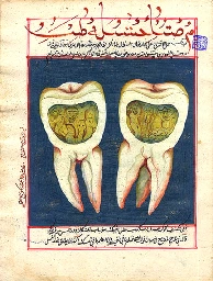 Tooth worm - Wikipedia