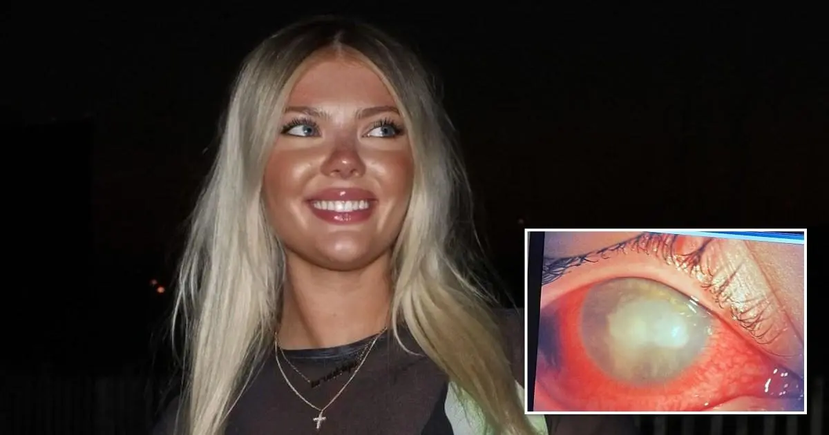 Woman blinded by parasites after making mistake with her contact lenses