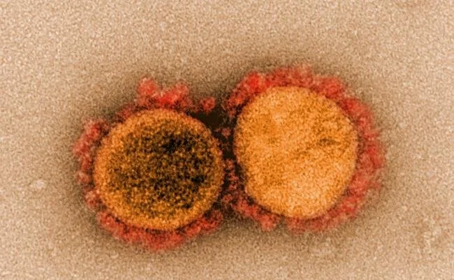 Study finds SARS-CoV-2-associated sepsis was more common, deadly than previously thought