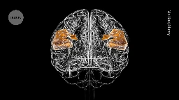 Brain-reading device is best yet at decoding ‘internal speech’