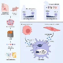 Possible markers identified for early metastatic lung cancer