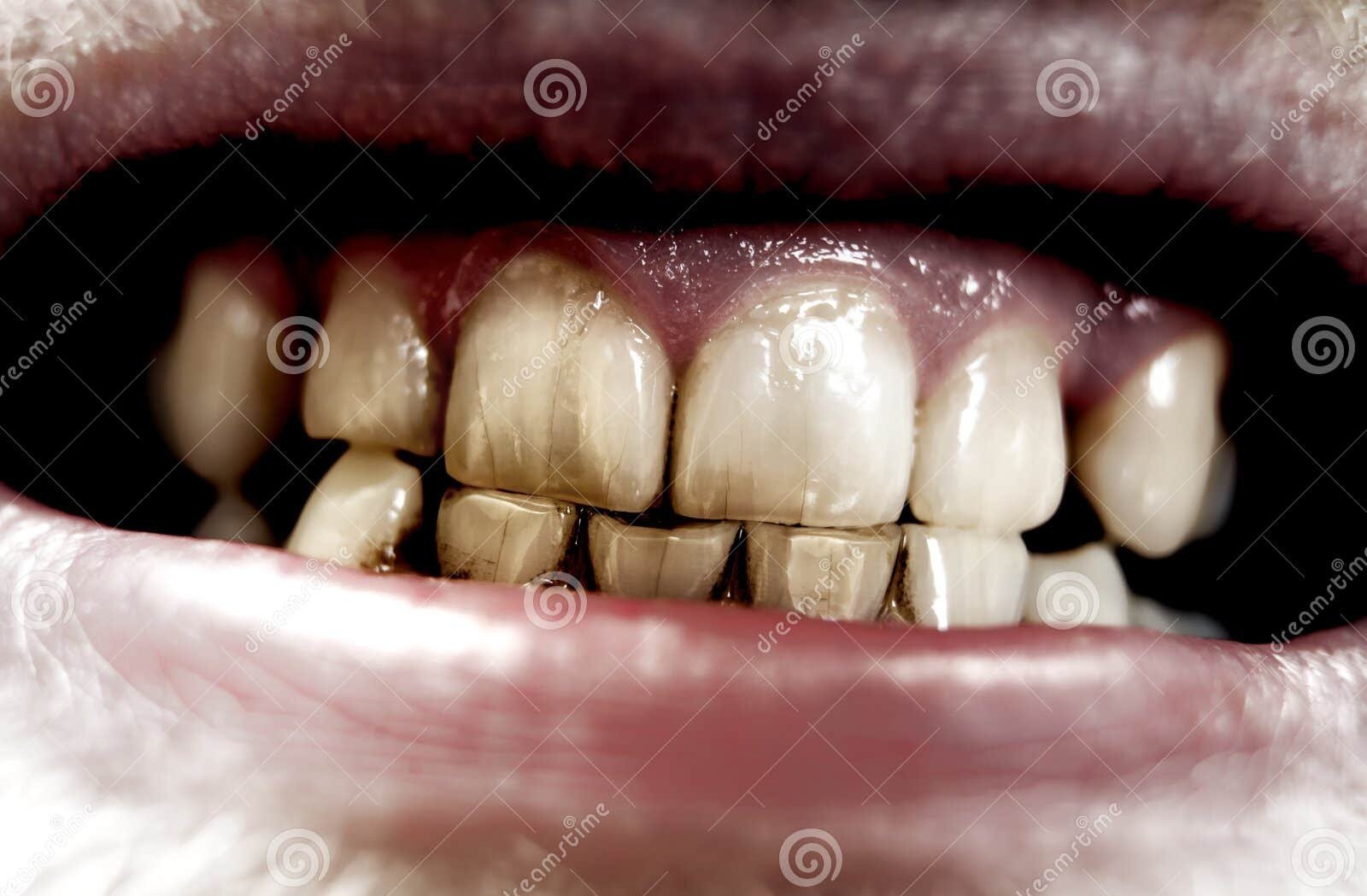 aggressive-teeth-6808471-2388783444