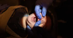Inside the Booming Business of Cutting Babies’ Tongues