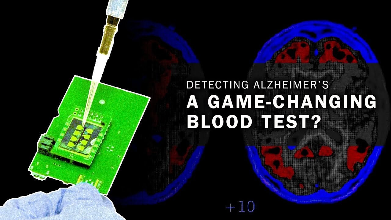 Can a simple blood test change how Alzheimer's is diagnosed? - 360