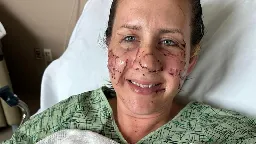 Woman attacked by 'vicious' otter: 'I did not think I was going to make it out of that river' | CNN