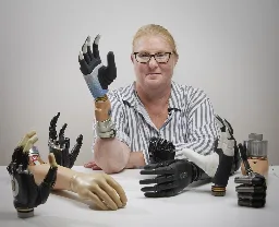 Revolutionising prosthetics: Groundbreaking achievement as bionic hand merges with user’s nervous and skeletal systems, remaining functional after years of daily use&nbsp; - Bionics Institute