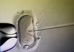 Case before Alabama Supreme Court could shut down fertility clinics, medical group warns