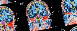 Hidden Consciousness Detected in 25% of Unresponsive Patients Tested