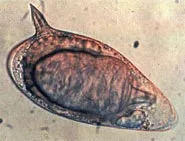 Schistosoma - Wikipedia