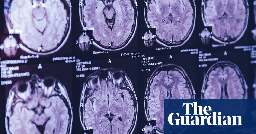 Top Canadian scientist alleges in leaked emails he was barred from studying mystery brain illness