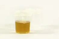 Scientists discover enzyme that makes urine yellow