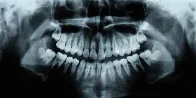 Humans Have a Third Set of Teeth. New Medicine May Help Them Grow.