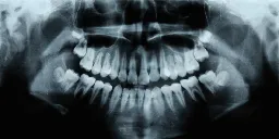 Humans Have a Third Set of Teeth. New Medicine May Help Them Grow.