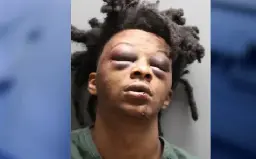 Video of Jacksonville Cops Beating 24-Year-Old Black Man Goes Viral | Atlanta Daily World