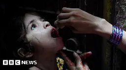 Polio cases surge in Pakistan ahead of vaccination campaign