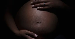 Pregnancy in America is starting to feel like a crime