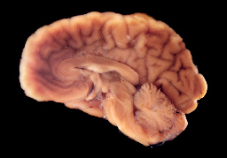Pig Brain Kept Alive for Five Hours While Separated from the Body