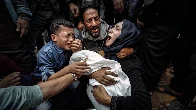 Gaza's Carnage Through the Eyes of Palestinian Photojournalists (NSFW)