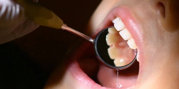 Do you need a dentist visit every 6 months? That filling? The data is weak