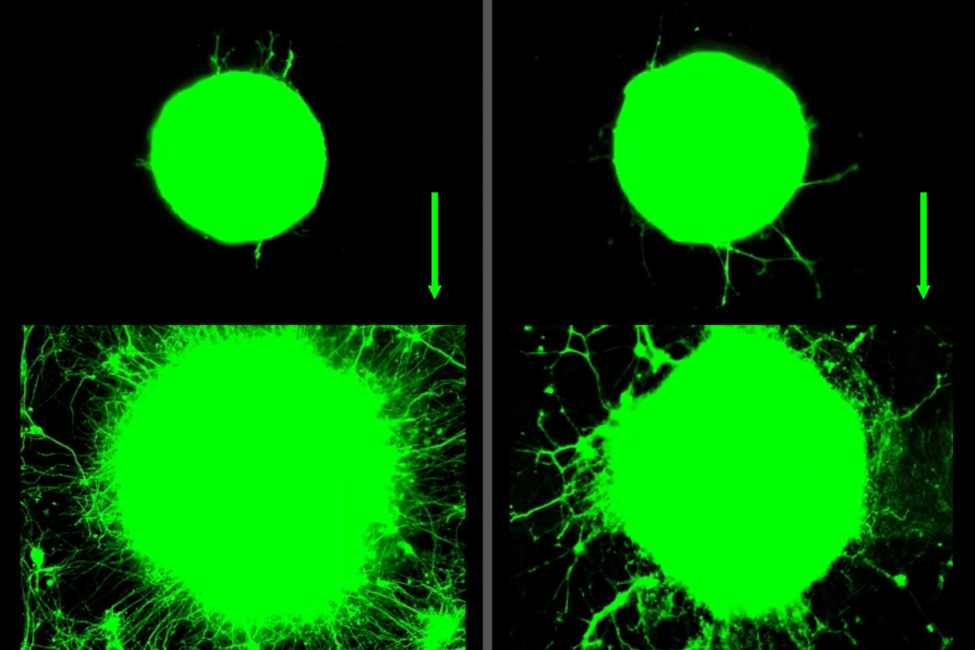 When muscles work out, they help neurons to grow, a new study shows