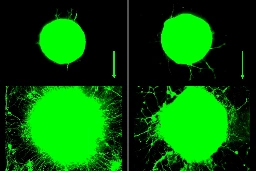 When muscles work out, they help neurons to grow, a new study shows