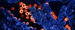 Scientists Discover a Genetic Variant That Seems to Limit HIV Infection