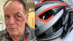 „Auf mich draufgeschossen“: Verletzter Rennradfahrer will seine Unschuld beweisen