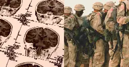 A Navy SEAL was convinced exposure to blasts damaged his brain, so he donated it to science to prove it