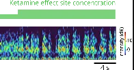 Study models how ketamine’s molecular action leads to its effects on the brain (2024)