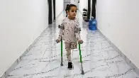 The Children Who Lost Limbs in Gaza