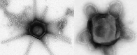 Freakishly Large Viruses With Arms And Tails Found in Massachusetts