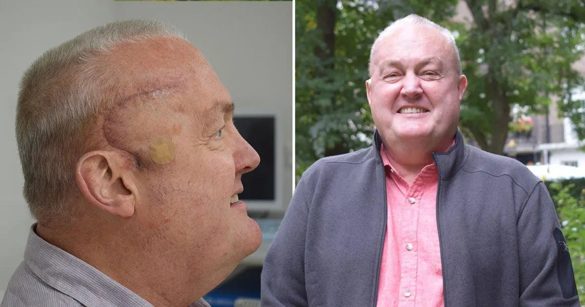 Man sees deadly brain tumour shrink by half thanks to new treatment