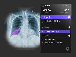 How to use AI for medical scans: just steal the training data