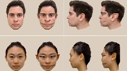 If Faces Appear Distorted, You Could Have This Condition | Dartmouth