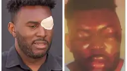 LA County Cuts a Check in Beating That Left Black Man Unrecognizable