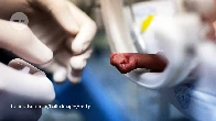 Human trials of artificial wombs could start soon — Nature