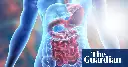 Bowel disease breakthrough as researchers make ‘holy grail’ discovery