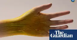 Common food dye found to make skin and muscle temporarily transparent