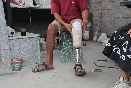 Precious Plastic Prosthetics