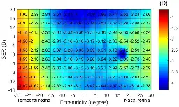 AI sees beyond humans: automated diagnosis of myopia based on peripheral refraction map using interpretable deep learning - Journal of Big Data