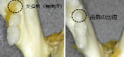 Clinical trial set to begin in Japan for medicine to help grow teeth