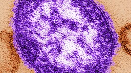 West Virginia confirms first measles case since 2009