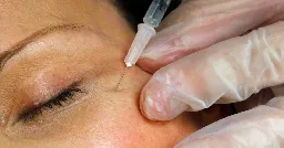 U.S. health officials warn of counterfeit Botox injections