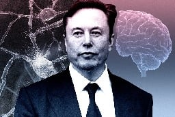 Elon Musk wants to implant millions of people with Neuralink brain chips