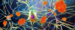 Study of 500,000 Medical Records Links Viruses With Alzheimer's Again And Again